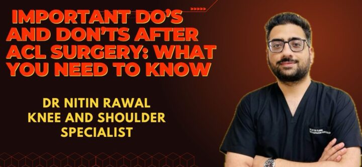 Important Do's and Don'ts After ACL Surgery
