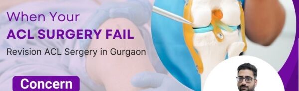 ACL Surgery in Gurgaon
