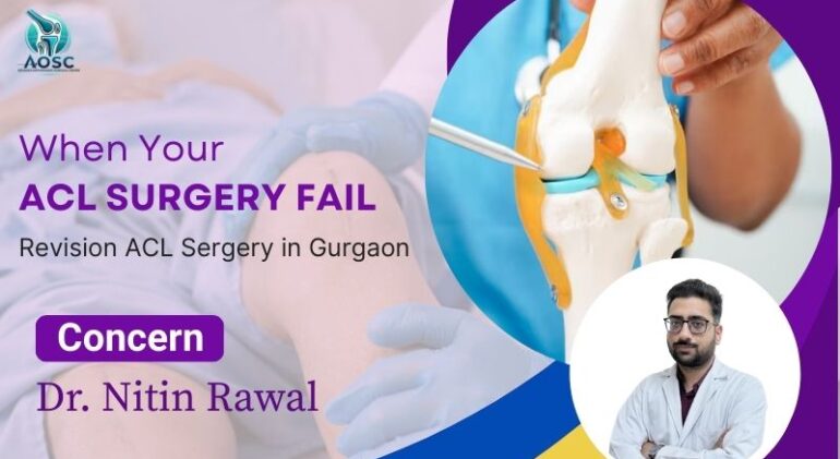 ACL Surgery in Gurgaon