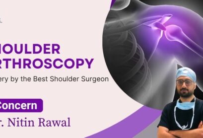 Best Shoulder Surgeon in Gurgaon