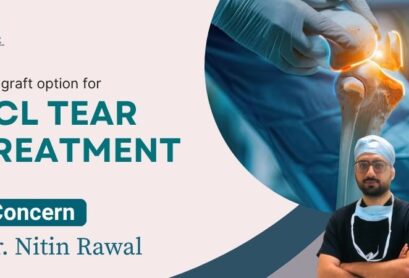 Best Graft Options for ACL Tear Treatment