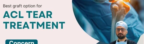 Best Graft Options for ACL Tear Treatment