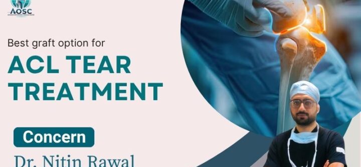 Best Graft Options for ACL Tear Treatment