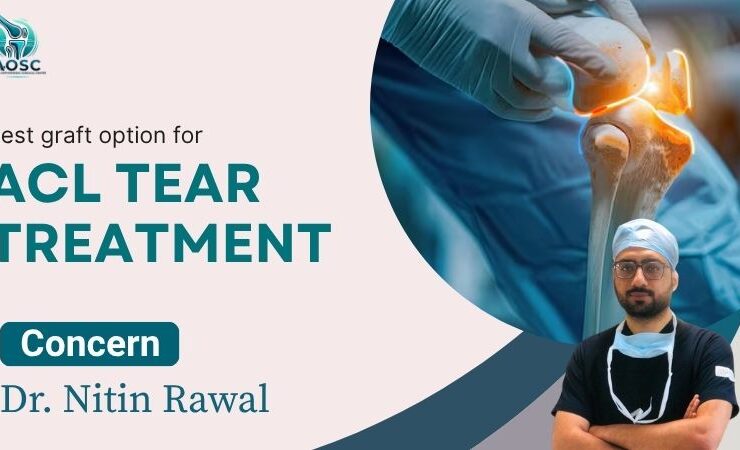 Best Graft Options for ACL Tear Treatment