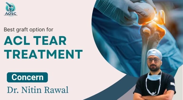 Best Graft Options for ACL Tear Treatment