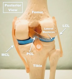 Meniscus Tears