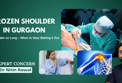 Frozen Shoulder in Gurgaon Frozen Shoulder in Gurgaon