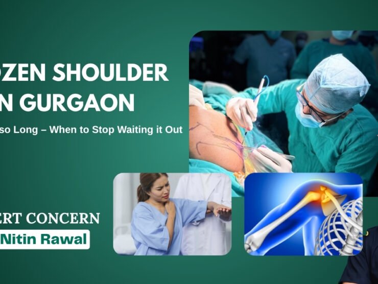 Frozen Shoulder in Gurgaon