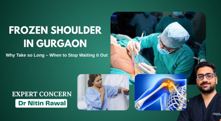 Frozen Shoulder in Gurgaon