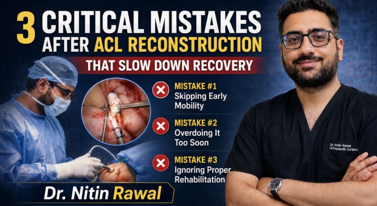 Mistakes After ACL Reconstruction