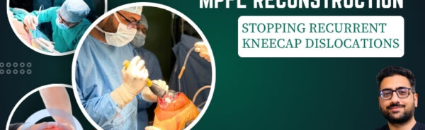 MPFL Reconstruction