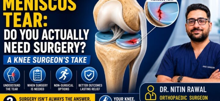 Best Knee Surgeon in Gurgaon Best Knee Surgeon in Gurgaon