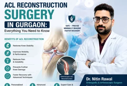 ACL Reconstruction Surgery in Gurgaon
